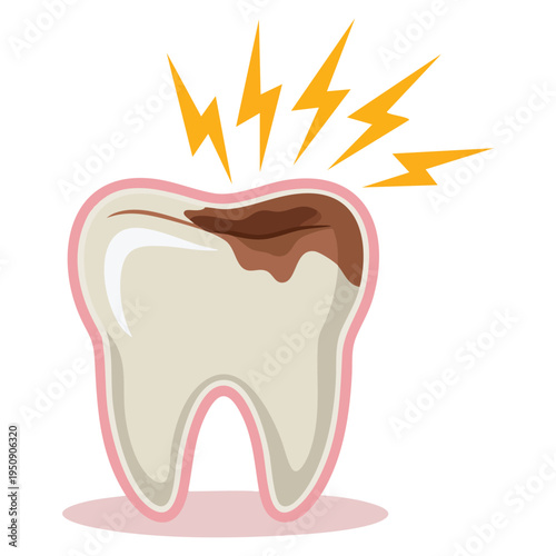 Isolated tooth cavity dental caries vector illustration ideal for dentistry awareness oral hygiene education concept and healthcare themed artwork