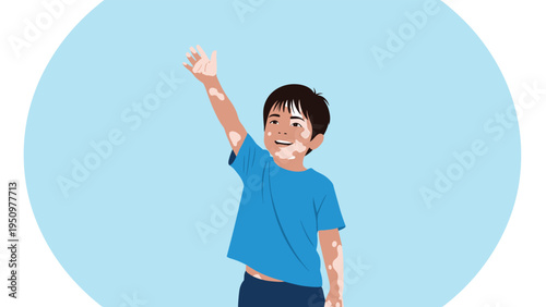 Happy young boy with vitiligo on his skin reaching up with his hand against a blue circular background frame.