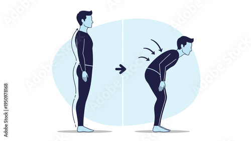 Diagram comparing correct standing posture versus poor slouched posture to demonstrate spinal health and ergonomics.