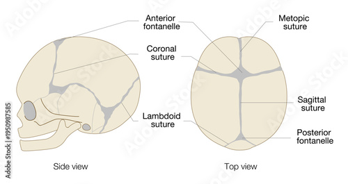 Infant skull anatomy diagram showing cranial sutures and fontanelle, top and side view