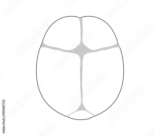 Infant skull anatomy diagram showing cranial sutures and fontanelle, top view