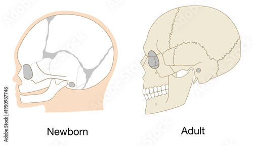 Comparison anatomy infant and adult skull development