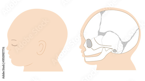 Infant skull anatomy diagram showing cranial sutures, side view
