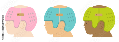 Black, White, and Asian babies wearing helmets for head shape correction