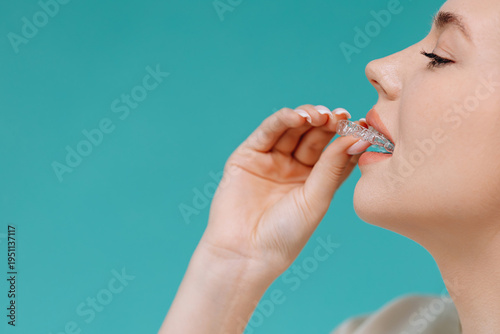Young woman inserting clear dental aligner for orthodontic treatment to straighten teeth and improve smile