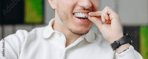 Young man inserting a clear aligner for smile correction with dental care and oral hygiene routine