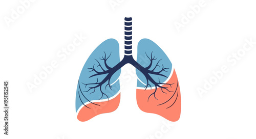 Anatomical illustration of human lungs with trachea and bronchi, highlighting healthy and diseased areas in blue and pink hues for tuberculosis awareness campaign