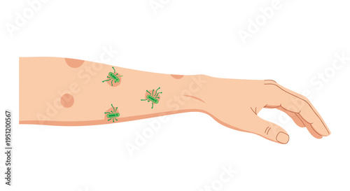 Human arm showing red inflamed spots and green insect-like parasites to illustrate skin irritation or parasitic infection.