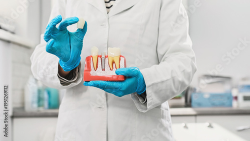 Tableau sur toile The doctor holds a dental implant in his hands and demonstrates how a titanium abutment is installed in the jaw