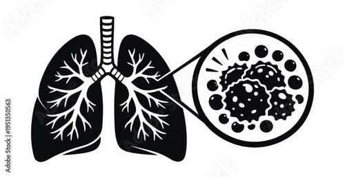 Lungs black diagram with magnified view of unhealthy cells representing bacterial, viral, or cancerous lung disease