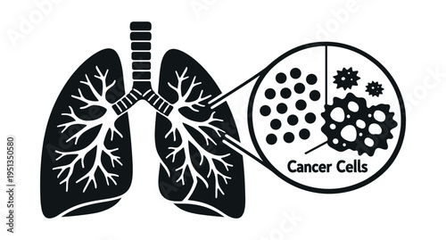 Lungs diagram with magnified view of healthy and malignant cells, illustrating the concept of lung cancer
