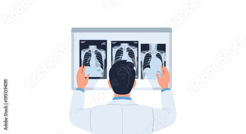 A doctor from behind holds three chest X-ray films against an illuminated panel on a white background.