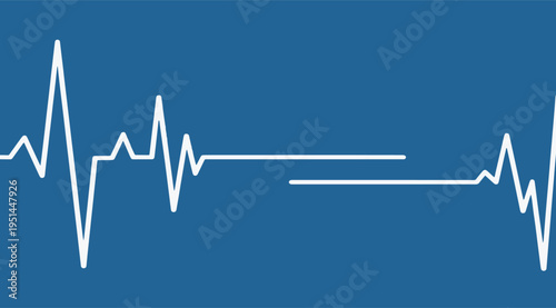 White heartbeat line on blue background with flatline section depicting medical emergency and vital signs monitoring