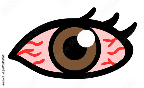 充血した目のイラストセット：眼精疲労・花粉症・目のトラブル