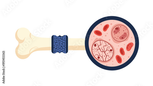 Human bone with a magnified view of bone marrow and blood cells, representing hematology, bone health, or medical research.