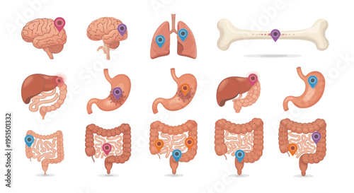 Human Organ Anatomy Illustrations with Disease Location Pins