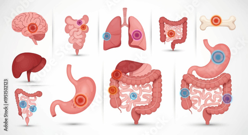 Human Internal Organs with Pain and Inflammation Medical Illustration
