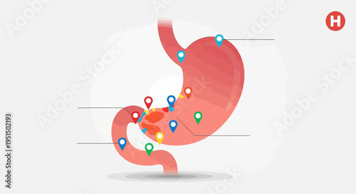 Medical Illustration of Human Stomach with Location Pins