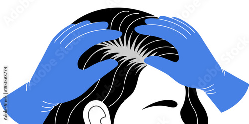 Vector illustration of a trichologist examining a female patient's scalp. Doctor hands in medical gloves checking thinning hair, hair loss treatment and dermatology concept.