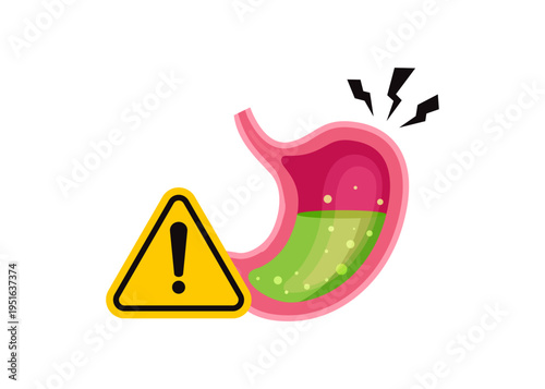 Human Stomach With Gastric Acid Pain And Warning Sign Stock Illustration.