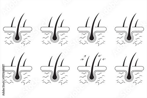 Hair follicle icon set with scalp skin diagrams for dermatology and medical education