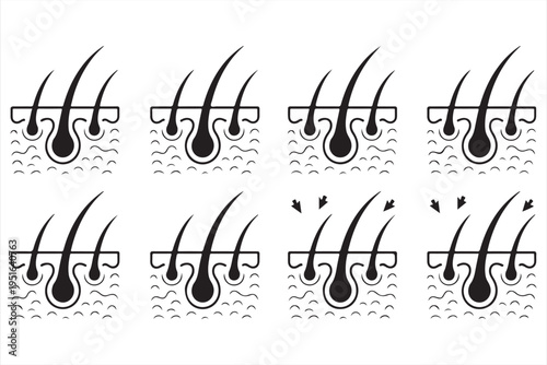 Medical hair follicle diagrams collection for clinic treatment and health awareness