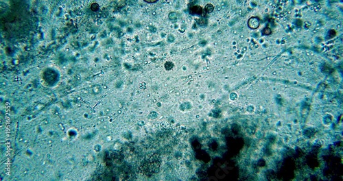 Biological Sample from Tree Trunk during Spring Flood showing Active Organisms after Soil Thawing for Ecological Research and Soil Microbiology Studies of Seasonal Life Cycle and Biodiversity Scene