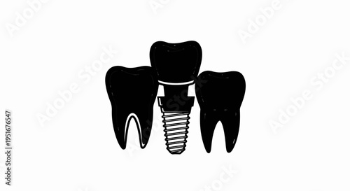 Stylized graphic of three teeth, one with a screw-in implant