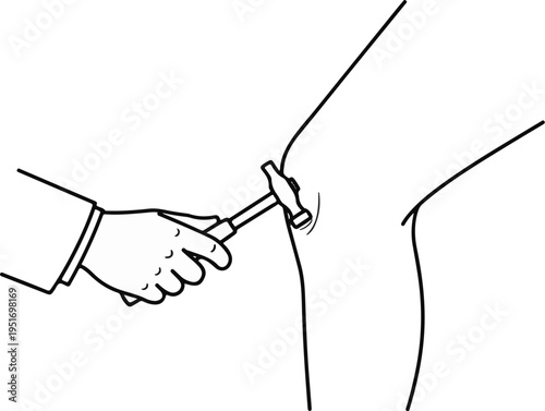 Medical examination of a knee reflex with a reflex hammer