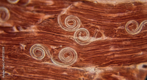 Trichinella spiralis larvae seen under a microscope. It is a parasitic nematode, enclosed in muscle tissue