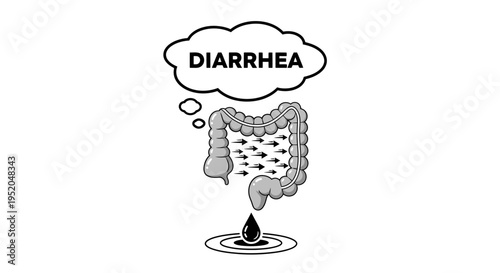 Human digestive system illustration with "Diarrhea" text bubble and intestine icon.