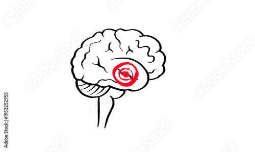 Brain disease concept