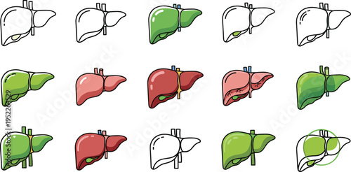 Liver anatomy icons set, healthy and diseased liver illustration, medical healthcare concept, organ condition stages, minimal outline design, vector collection