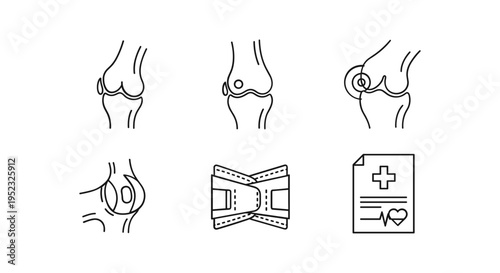 Knee Injury Medical Illustration and Diagnosis.