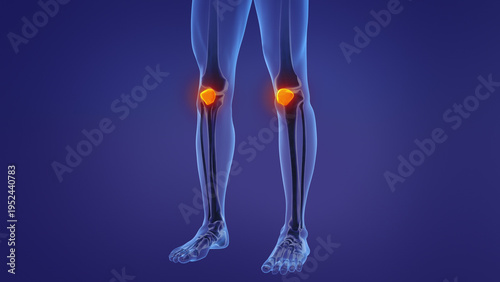 Tableau sur toile Anatomy of the human patella