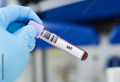 Blood sample tube for indirect coomb test analysis.