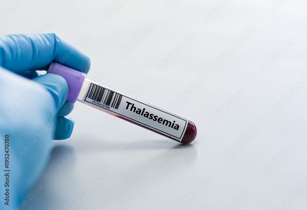 Obraz premium Blood sample tube for thalassemia test analysis.