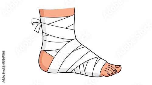 Human ankle and foot are neatly wrapped in a white medical bandage after a sports injury showing proper first aid care and recovery procedures.