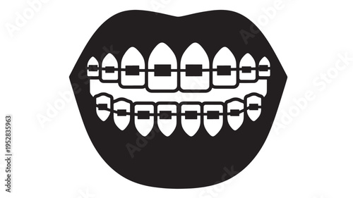 Mouth with dental braces showing straight teeth and gums, black icon. featuring orthodontics, straightening, alignment with smile and healthcare