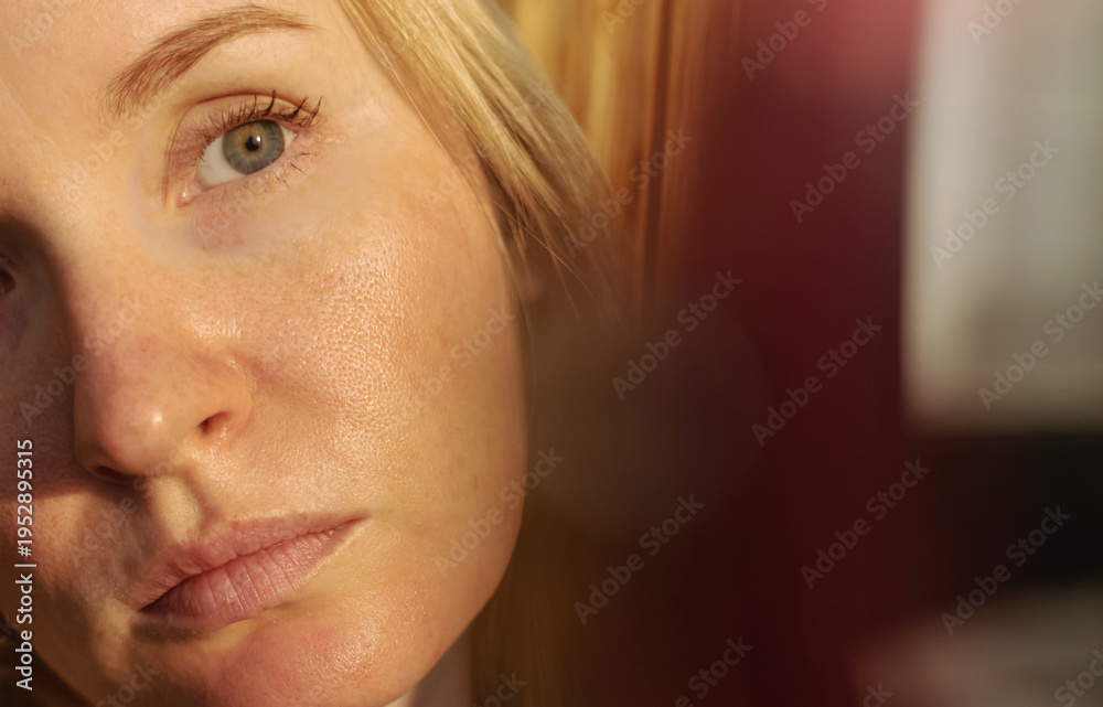 custom made wallpaper toronto digitalClose-up of female face with enlarged pores and oily skin, visible texture, redness on chin. Natural light beauty portrait, skincare concerns, dermatology concept.