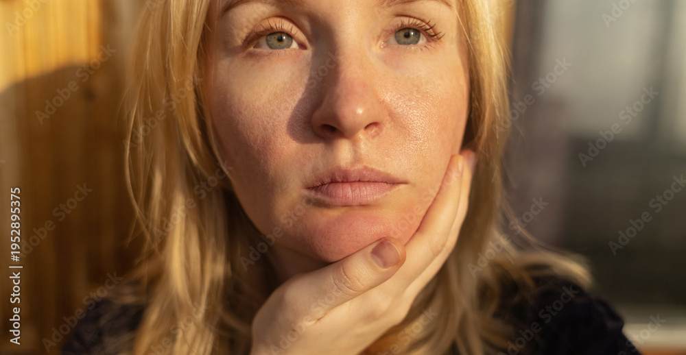 custom made wallpaper toronto digitalClose-up of female face with enlarged pores and oily skin, visible texture, redness on chin. Natural light beauty portrait, skincare concerns, dermatology concept.