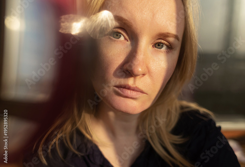 Wallpaper Mural Close-up of female face with enlarged pores and oily skin, visible texture, redness on chin. Natural light beauty portrait, skincare concerns, dermatology concept. Torontodigital.ca