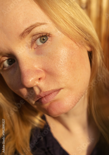 Wallpaper Mural Close-up of female face with enlarged pores and oily skin, visible texture, redness on chin. Natural light beauty portrait, skincare concerns, dermatology concept. Torontodigital.ca