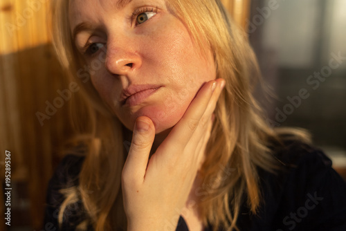 Wallpaper Mural Close-up of female face with enlarged pores and oily skin, visible texture, redness on chin. Natural light beauty portrait, skincare concerns, dermatology concept. Torontodigital.ca