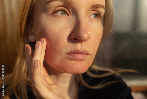 Wallpaper Mural Close-up of female face with enlarged pores and oily skin, visible texture, redness on chin. Natural light beauty portrait, skincare concerns, dermatology concept. Torontodigital.ca