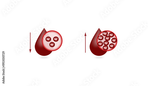 Hypernatremia, high plasma sodium level and Hyponatremia, low plasma sodium level. Sodium Na excess and deficit electrolyte disorders, blood test tube, Scientific design. Vector illustration.