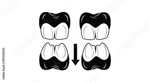 Teeth Whitening Process Before And After Dental Care Concepts
