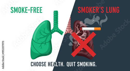 Healthy Lung Versus Smoker Lung.