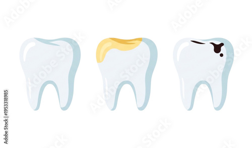 A vector graphic illustration of three teeth with different dental problems