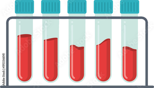 Rack of five blood test tubes with red liquid and blue caps for medical research and healthcare laboratory analysis